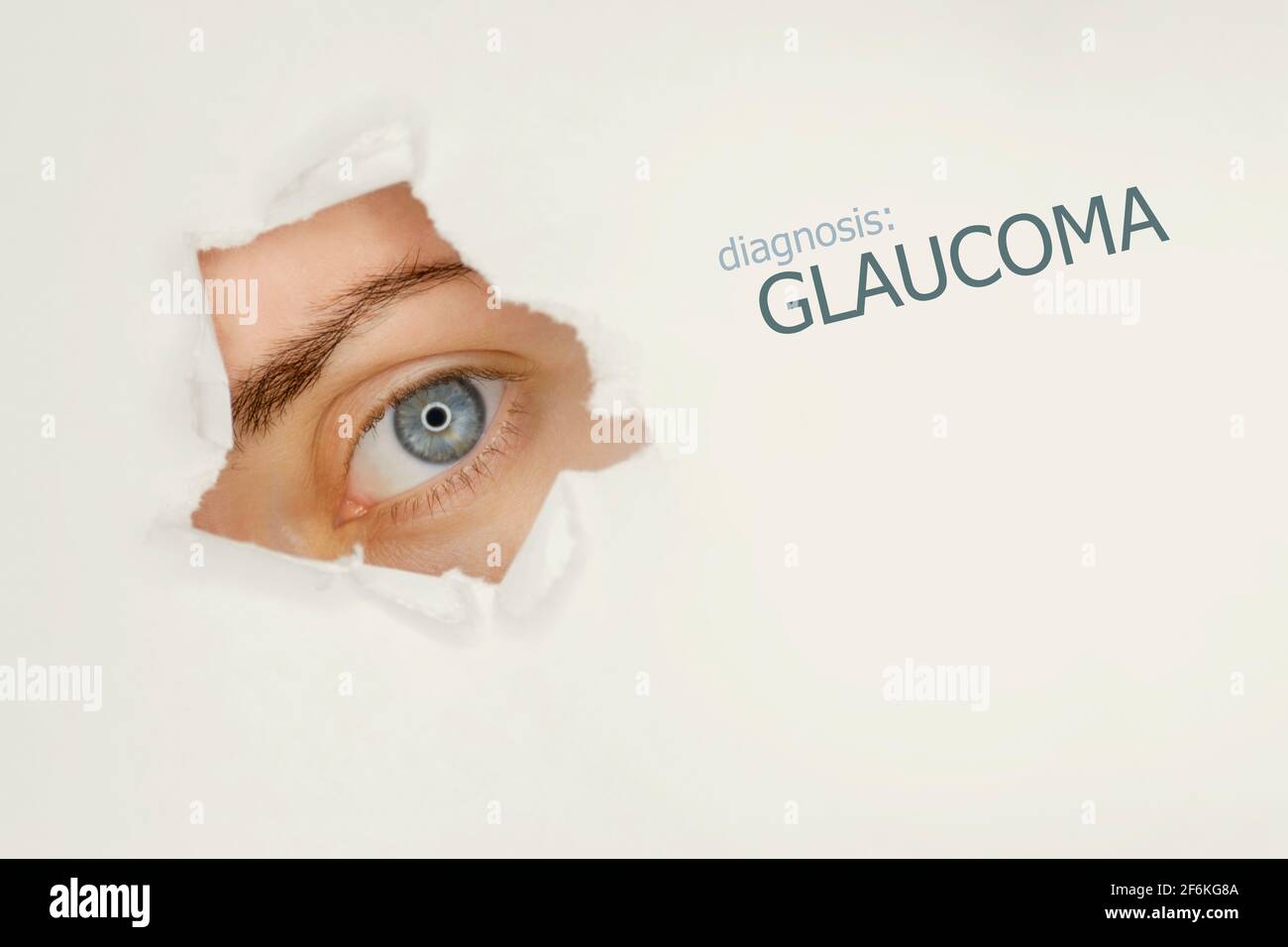 Woman`s eye looking trough teared hole in paper, word Glaucoma on right. Eye disease concept template. grey background. Stock Photo